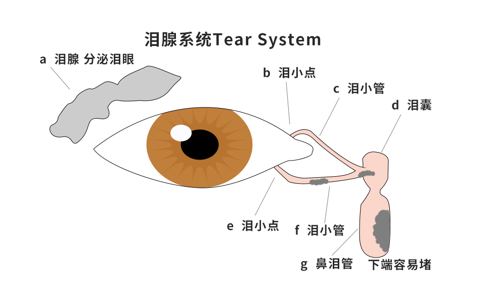 泪囊炎